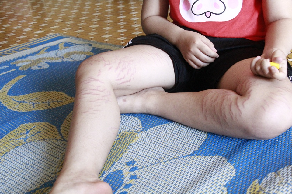 Cuộc sống khốn khó của nữ sinh giàu nghị lực có đôi mắt sáng long lanh nhưng...sắp mù - 8 Cuộc sống khốn khó của nữ sinh giàu nghị lực có đôi mắt sáng long lanh nhưng...sắp mù - 8