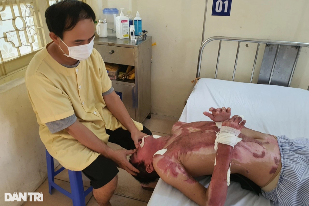 Cú phóng điện cao thế khiến cậu bé 14 tuổi bỏng 55% cơ thể, tay biến dạng - 5 Cú phóng điện cao thế khiến cậu bé 14 tuổi bỏng 55% cơ thể, tay biến dạng - 5