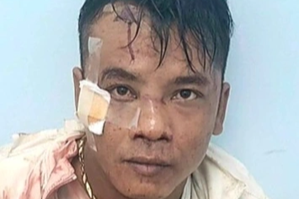 Truy đuổi hơn 6km bắt đối tượng giật dây chuyền - 1 Truy đuổi hơn 6km bắt đối tượng giật dây chuyền - 1