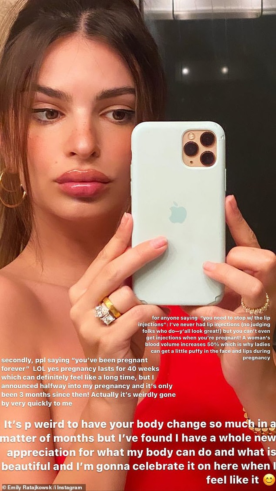 Emily Ratajkowski phủ nhận tin đồn bơm môi - 1 Emily Ratajkowski phủ nhận tin đồn bơm môi - 1