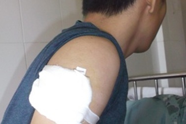 Mâu thuẫn, cô gái 19 tuổi thuê "giang hồ" đến tận nhà chém người