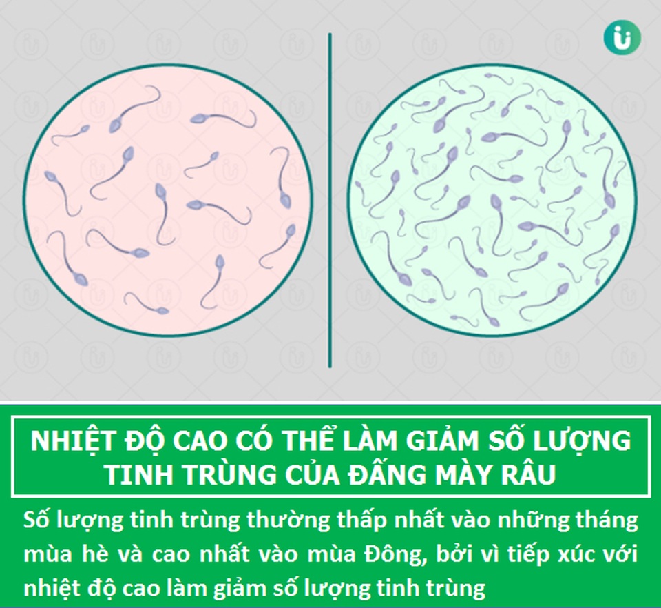 Bất ngờ với những sự thật ít biết về “đội quân” tí hon của các chàng - 7 Bất ngờ với những sự thật ít biết về “đội quân” tí hon của các chàng - 7