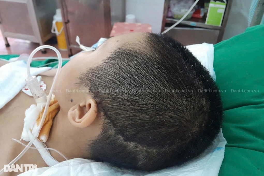 Nữ sinh lớp 8 bất động trên giường bệnh, mẹ nghèo khẩn cầu - 2 Nữ sinh lớp 8 bất động trên giường bệnh, mẹ nghèo khẩn cầu - 2