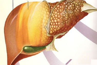 Trẻ em cũng mắc bệnh gan nhiễm mỡ