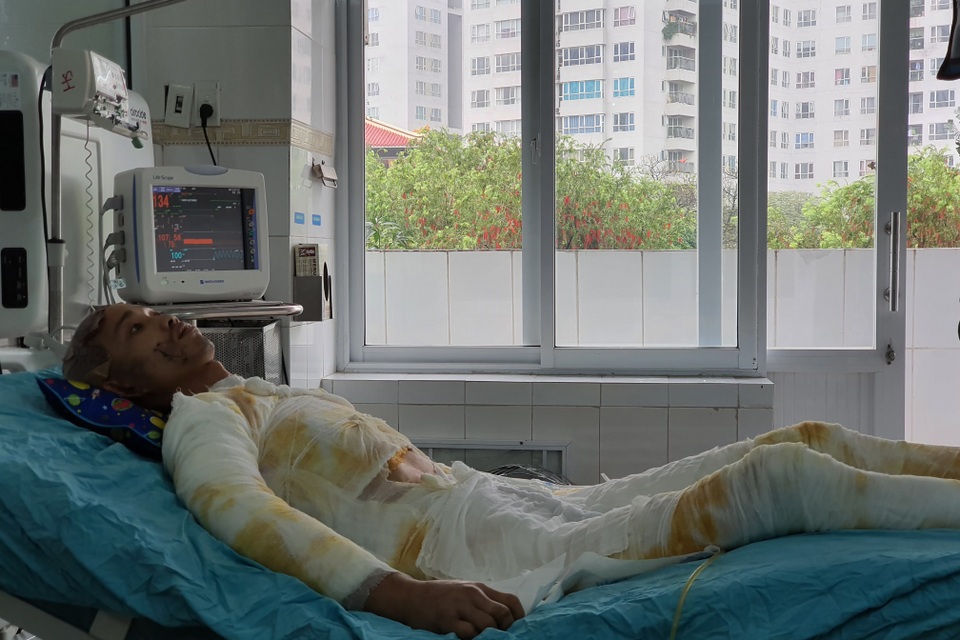 Chàng trẻ nguy kịch sau vụ tai nạn thương tâm mất nửa phần da cơ thể - 2 Chàng trẻ nguy kịch sau vụ tai nạn thương tâm mất nửa phần da cơ thể - 2