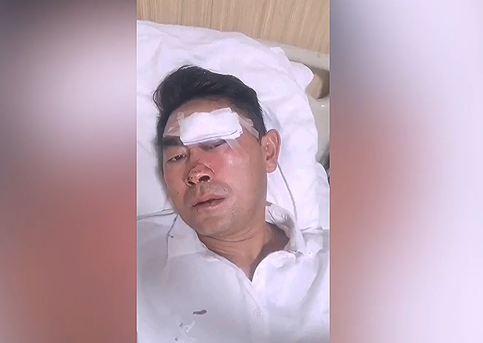 Li Wenjun bị thương và được chăm sóc tại bệnh viện sau khi cứu em bé khỏi cú ngã. Li Wenjun bị thương và được chăm sóc tại bệnh viện sau khi cứu em bé khỏi cú ngã.