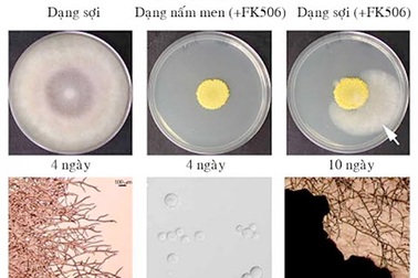 Phát hiện cơ chế “ức chế tạm thời” giúp vi sinh vật kháng thuốc