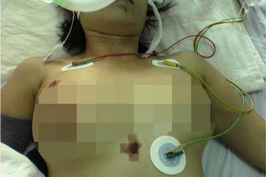 Liều mạng làm đẹp