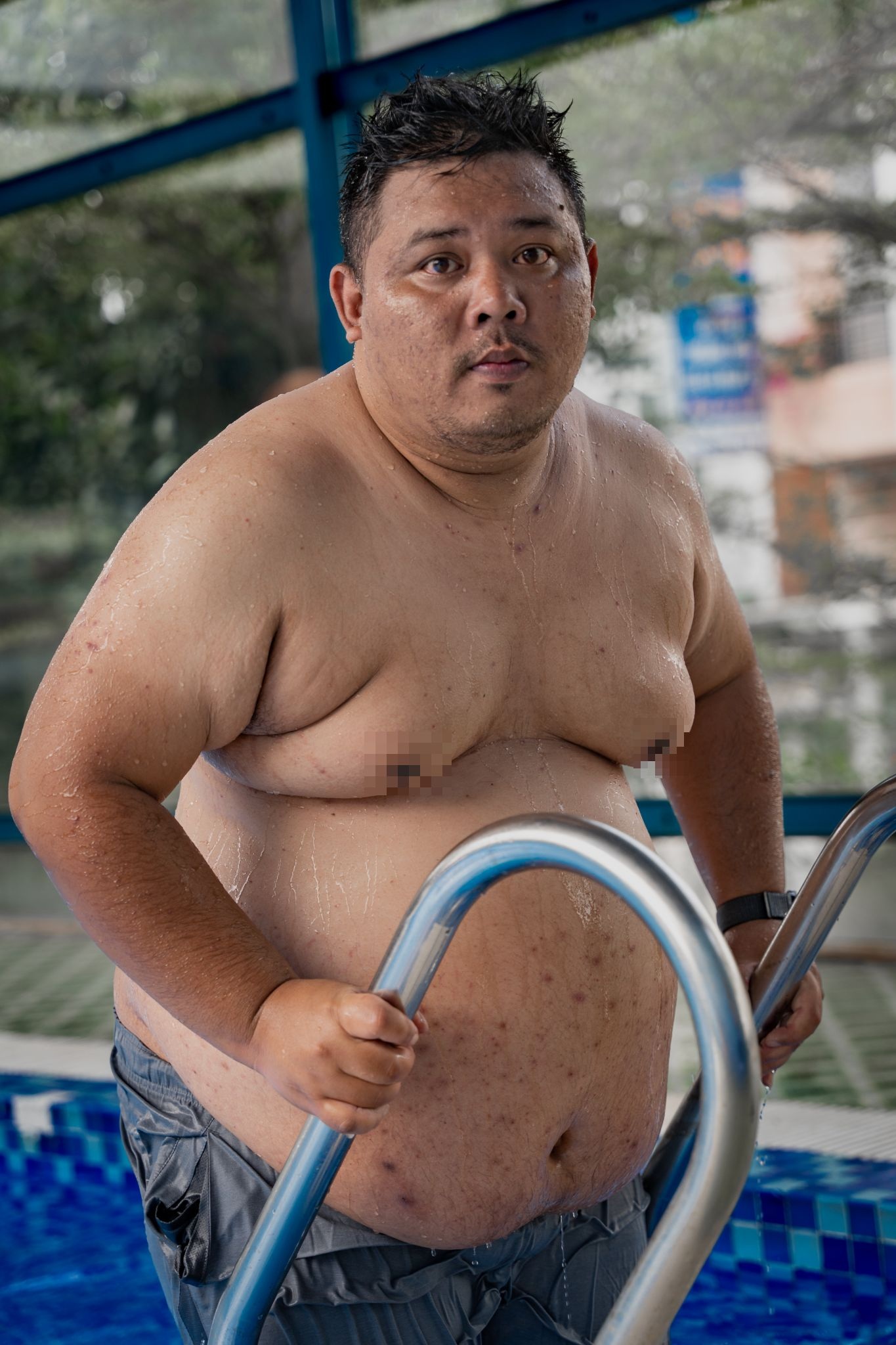 View - Chàng trai 170kg giảm 80kg: Ngủ cũng sợ tắt thở, "bỏ hết" lên núi giảm cân | Báo Dân trí