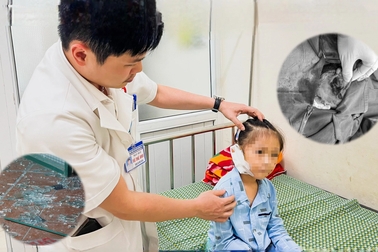 Bé gái 6 tuổi bị đứt tai vì kính vỡ trong lúc chơi đùa ở nhà