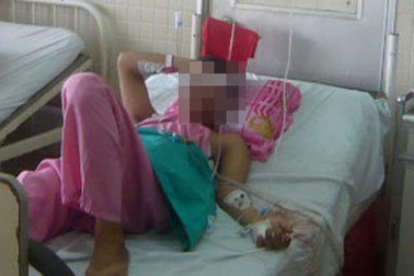 Cứu sống bệnh nhân gần cạn máu vì tự đâm vào ngực