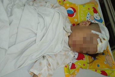 Nỗi lo tai nạn ngày hè