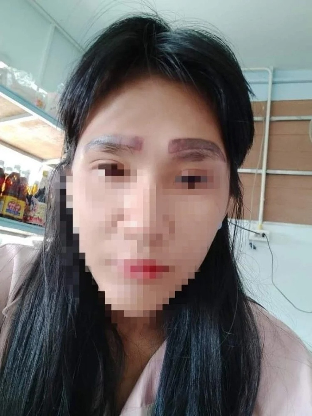 Cô gái khóc ròng vì có hai cặp lông mày sau khi phun xăm thẩm mỹ giá rẻ - 1 Cô gái khóc ròng vì có hai cặp lông mày sau khi phun xăm thẩm mỹ giá rẻ - 1