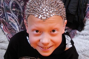 Cậu bé biến đầu trọc của mình thành… “nhím”