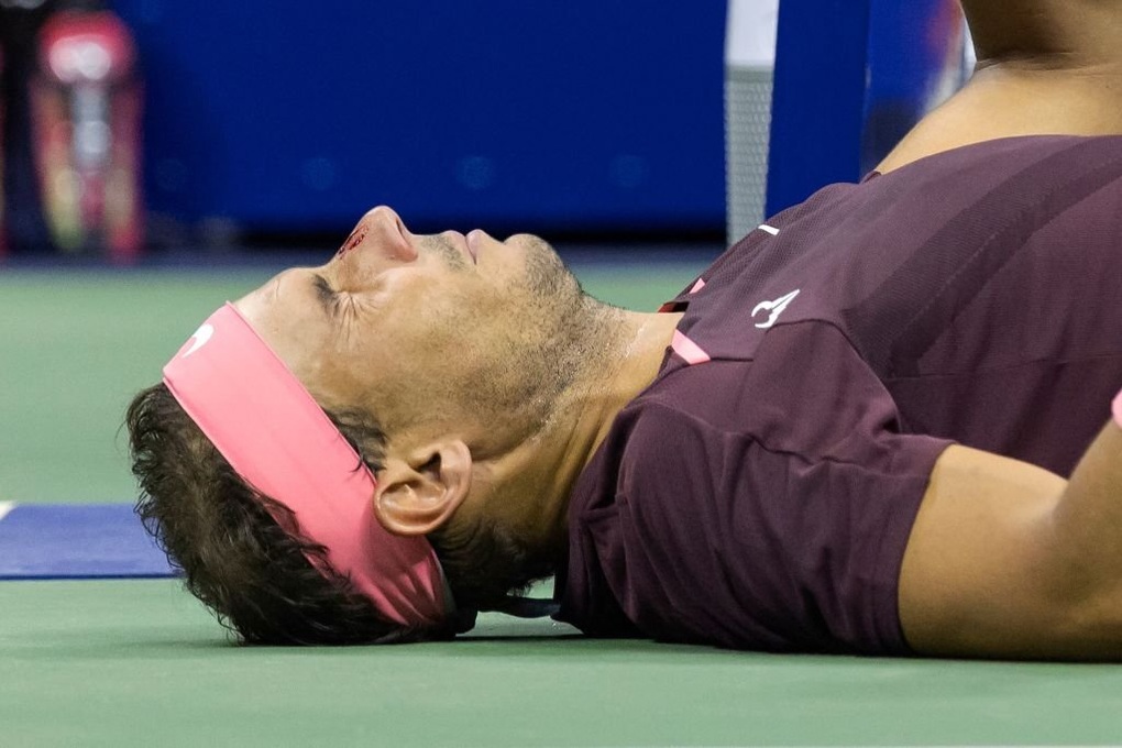 Nadal đổ máu trong chiến thắng trước Fognini - 1 Nadal đổ máu trong chiến thắng trước Fognini - 1