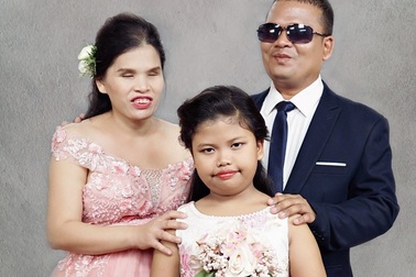 Bộ ảnh cưới của 15 cặp đôi khuyết tật khiến người xem rơi lệ