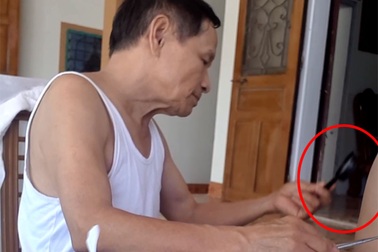 “Choáng” với cách kiểm tra bệnh dại của thầy lang ở Hà Tĩnh