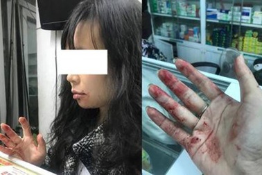 Hà Nội: Lái xe Uber đánh nữ hành khách chảy máu mồm