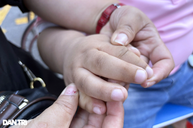 6 triệu người Việt mắc bệnh hiếm