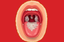 Các trường hợp tiếp xúc nữ bệnh nhân tử vong vì bạch hầu