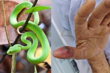 Rắn độc "nấp" trong nhà vệ sinh cắn người vừa ngủ dậy