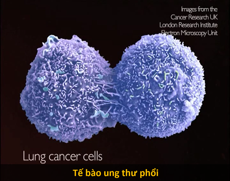 Cận cảnh hình hài những tế bào “chết chóc nhất mà con người từng biết đến - 2 Cận cảnh hình hài những tế bào “chết chóc nhất mà con người từng biết đến - 2