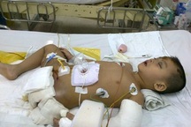 Bé trai cụt chân, mất cả cha lẫn mẹ trong tai nạn