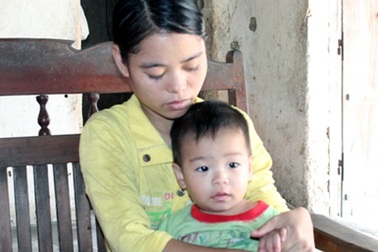 Sau phẫu thuật cắt “u nang đầu tụy”, bệnh nhân mất túi mật