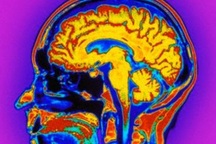 Tìm thấy bằng chứng điện thoại di động gây ung thư