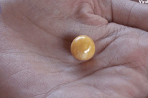 Cô gái nghèo "đổi đời" nhờ nhặt được viên ngọc trai quý hiếm khi ăn ốc