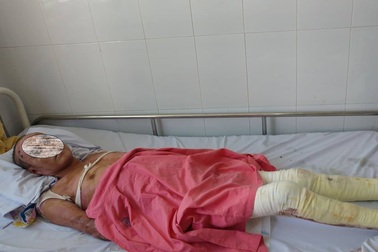 Hàn thùng chứa dầu, thợ sửa xe bị lửa thiêu sống