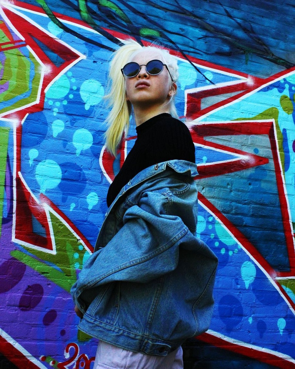 Cô gái bạch tạng từng bị cha mẹ bỏ rơi, trở thành người mẫu tạp chí Vogue - 3