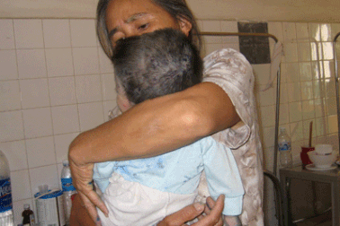 Cảnh giác biến chứng viêm não khi bị thủy đậu