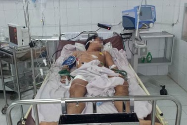 Uống rượu đế, 1 người chết, 2 người nguy kịch