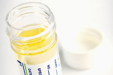 Xét nghiệm tại nhà phát hiện sớm ung thư tuyến tiền liệt