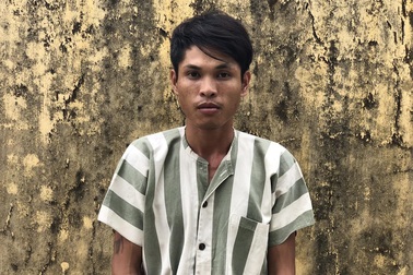 Nghi án bạo hành con riêng của “vợ hờ”: Nạn nhân có tỷ lệ thương tích 63%