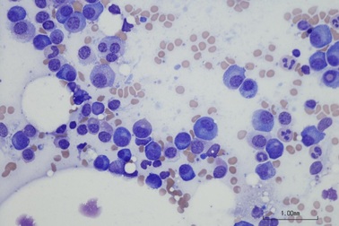 Có thể ngăn chặn ung thư lây lan bằng thuốc cảm lạnh thông thường