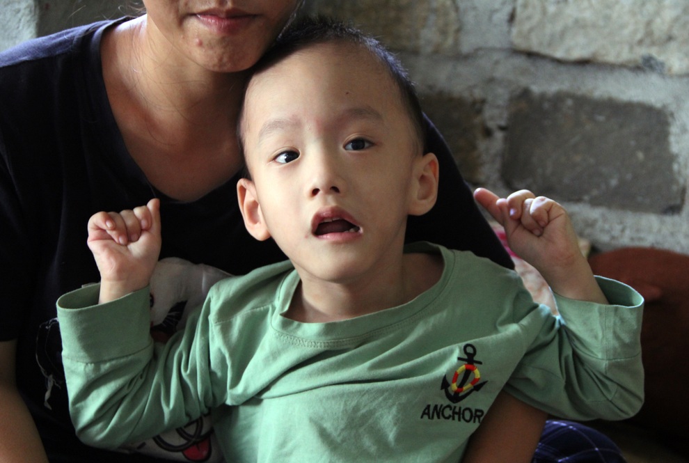 Cậu bé 6 tuổi nghẹn ngào cầu xin các nhà hảo tâm giúp đôi chân em lành lặn - 4 Cậu bé 6 tuổi nghẹn ngào cầu xin các nhà hảo tâm giúp đôi chân em lành lặn - 4