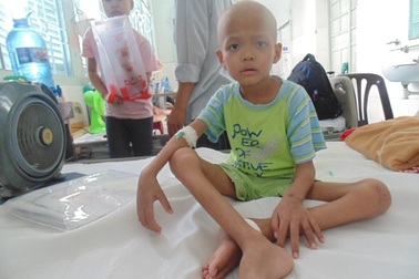 Bé trai 6 tuổi nguy kịch vì bệnh ung thư hạch