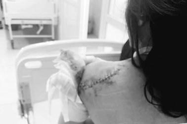 Bảo vệ người phụ nữ cầu cứu "bị truy sát 2 lần"