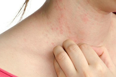 Những dấu hiệu cảnh báo sớm ung thư thường bị chúng ta "làm ngơ"