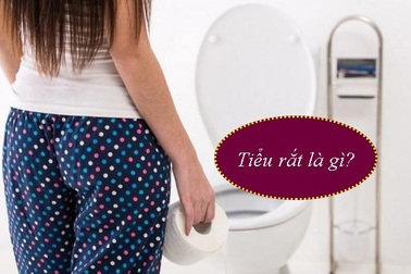 3 thói quen khiến chị em văn phòng dễ mắc chứng tiểu rắt và biện pháp đẩy lùi từ Thực phẩm bảo vệ sức khỏe Ích Tiểu Vương