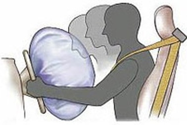 Túi khí nổ gây tổn thương thính giác