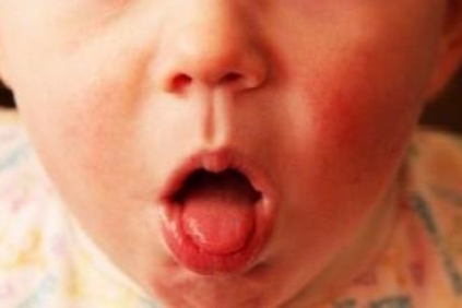 Chưa được tiêm vaccine phòng ho gà, bé 2 tháng tuổi đã mắc bệnh nguy kịch