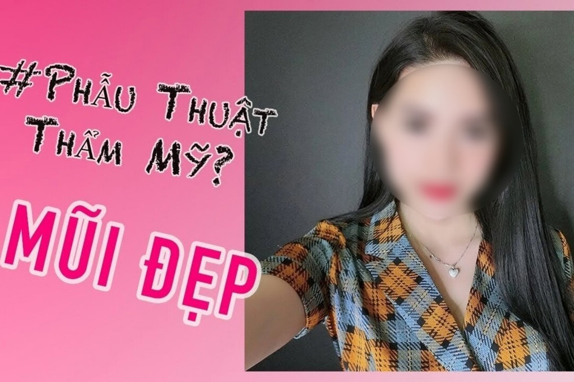 Sự thật đằng sau những bài đăng cổ vũ phẫu thuật thẩm mỹ trên mạng - 2 Sự thật đằng sau những bài đăng cổ vũ phẫu thuật thẩm mỹ trên mạng - 2