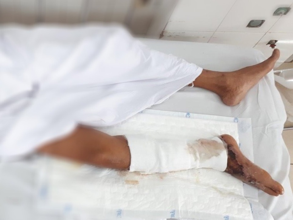 Ăn gỏi cá rô phi, người đàn ông suýt mất mạng vì nhiễm độc tả biển - 1 Ăn gỏi cá rô phi, người đàn ông suýt mất mạng vì nhiễm độc tả biển - 1