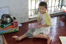 Không tiền phẫu thuật, bé 8 tuổi khổ sở với bàn chân chỉ còn... một ngón