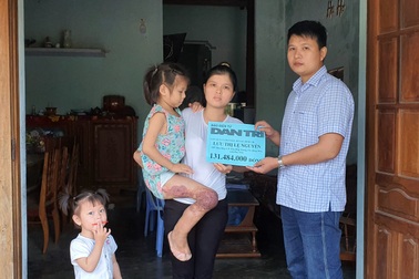 Bạn đọc Dân trí giúp đỡ bé gái hơn 130 triệu đồng tìm sự sống mong manh