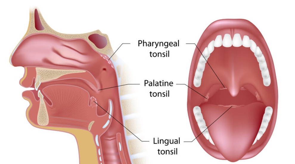 Phòng ngừa ung thư amidan - 1 Phòng ngừa ung thư amidan - 1