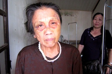 Cụ bà 70 tuổi bị một thanh niên bóp cổ, đánh bầm mặt